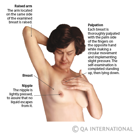 Breast Self Examination 